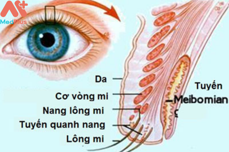 Nguyên nhân của bệnh lẹo mắt