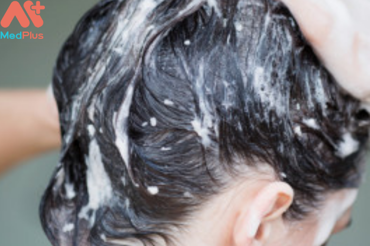 Cách phòng ngừa tóc bạc ở tuổi trẻ