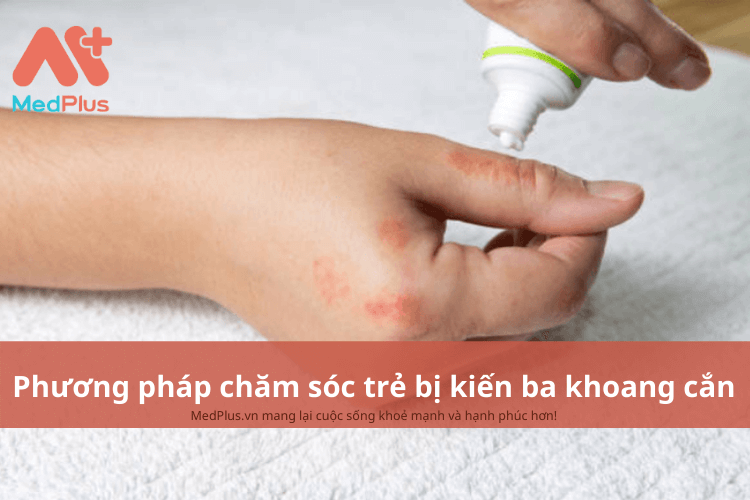 Phương pháp chăm sóc cho trẻ bị kiến ba khoang cắn an toàn và hiệu quả