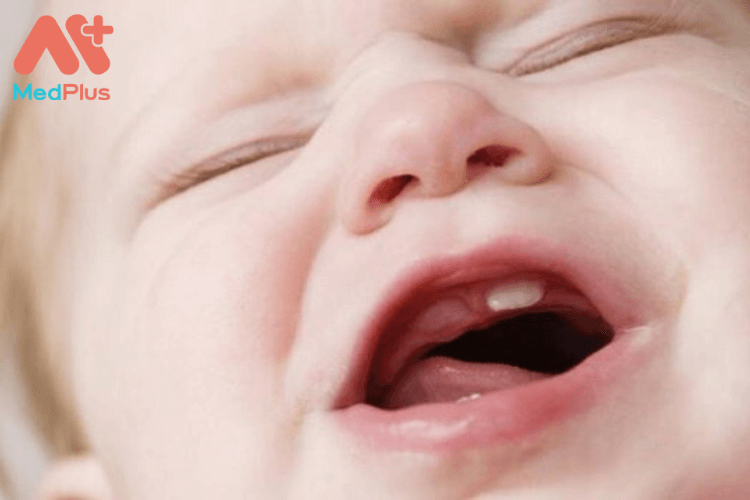 Phương pháp chăm sóc trẻ bị sốt mọc răng an toàn và hiệu quả