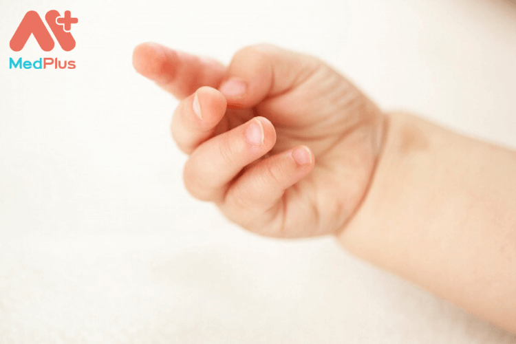 Phương pháp chăm sóc trẻ bị trật khớp ngón tay an toàn và hiệu quả