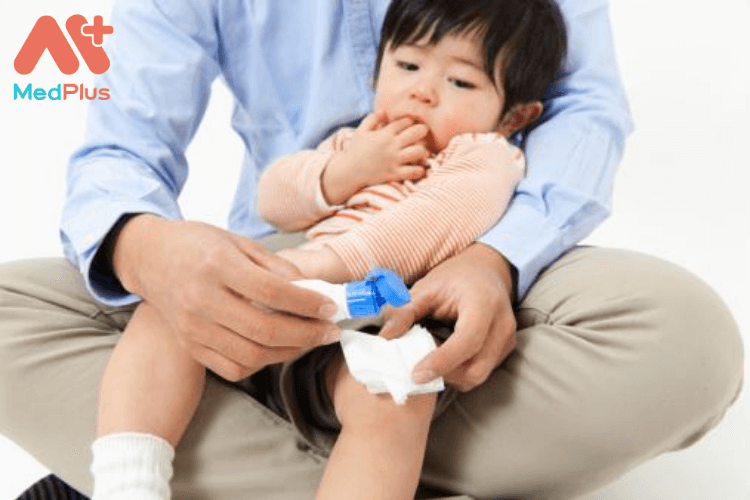 Phương pháp chăm sóc trẻ bị vết thương hở an toàn và hiệu quả