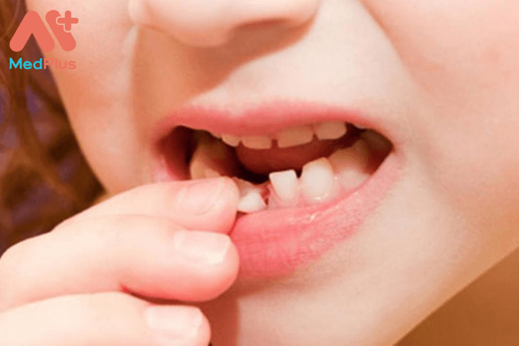 Phương pháp chăm sóc trẻ đang thay răng an toàn và hiệu quả