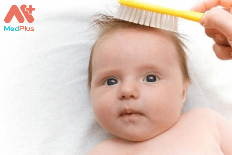 Trẻ nhỏ bị chậm mọc tóc có sao không? Những điều bố mẹ cần biết 