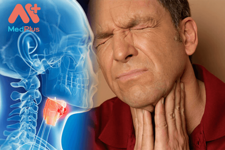 triệu chứng của ung thư vòm họng