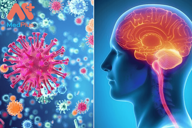 Bệnh viêm màng não là gì