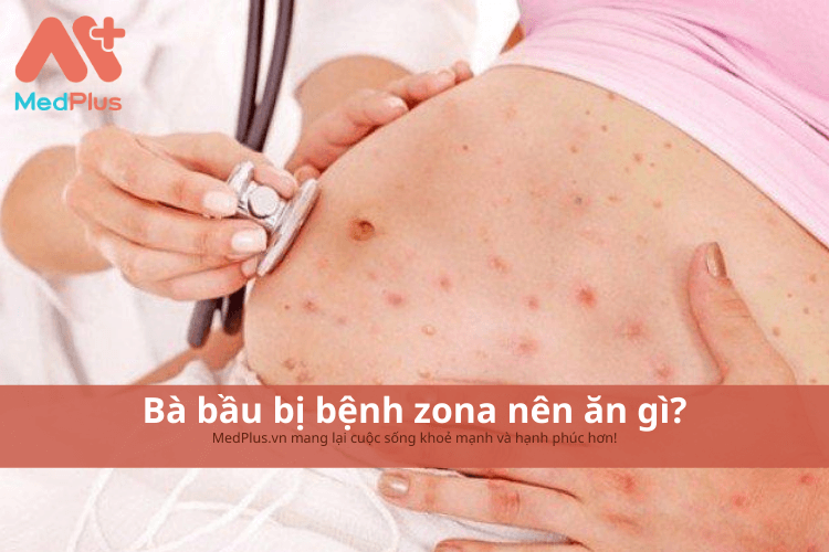 Bà bầu bị bệnh zona nên ăn gì ?