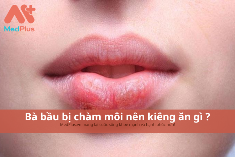 Bà bầu bị chàm môi ? Bị chàm môi nên và không nên ăn gì ?