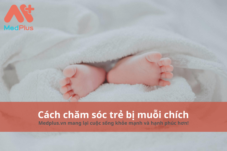 cách chăm sóc trẻ bị muỗi chích