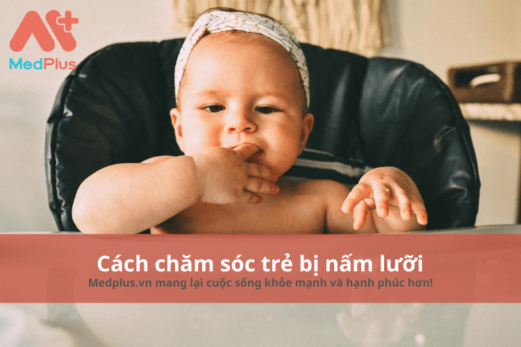 cách chăm sóc trẻ bị nấm lưỡi
