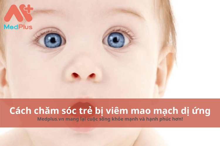 cách chăm sóc trẻ bị viêm mao mạch dị ứng