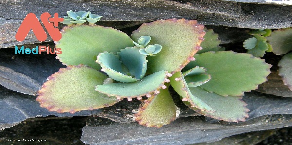 chua-tri-vet-thuong-bong-voi-duoc-lieu-cay-thuoc-bong