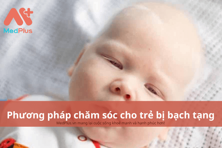 Phương pháp chăm sóc trẻ bị bạch tạng an toàn và hiệu quả