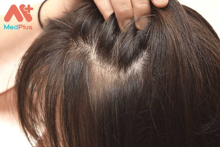 Phương pháp chăm sóc trẻ bị tóc bạc sớm an toàn và hiệu quả