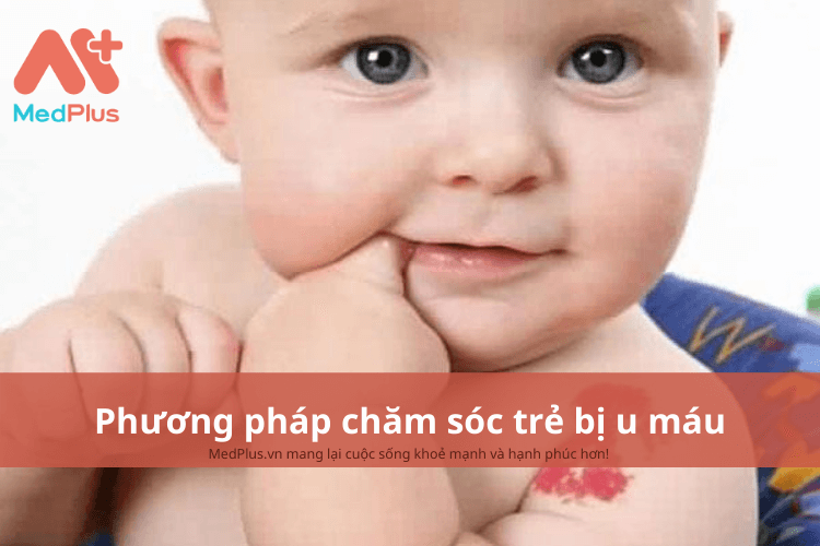 Phương pháp chăm sóc trẻ bị u máu an toàn và hiệu quả