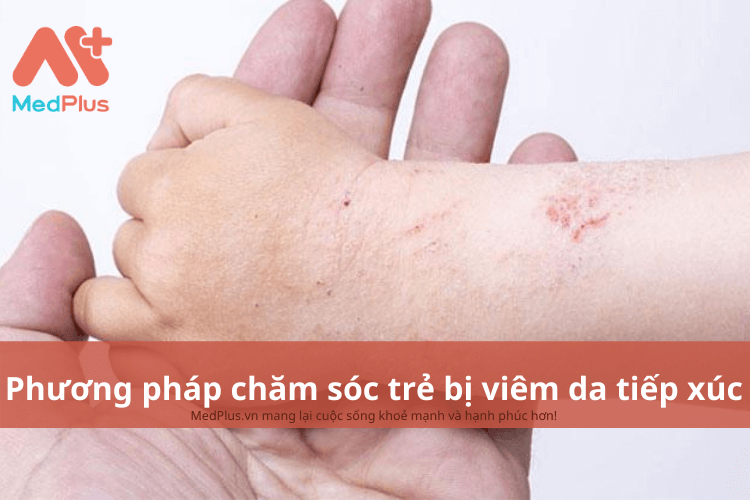 Phương pháp chăm sóc trẻ bị viêm da tiếp xúc an toàn và hiệu quả