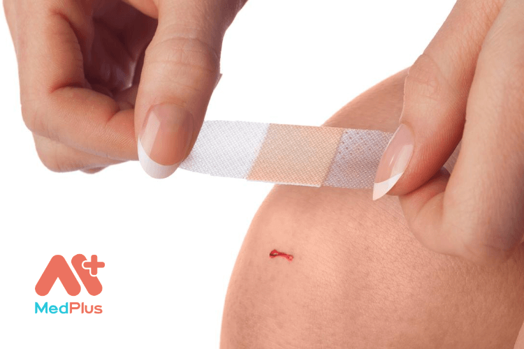 Thức uống cho người bị vết thương hở