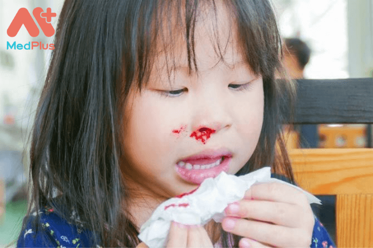Trẻ nhỏ bị rối loạn chảy máu có sao không?