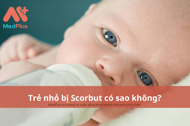 Trẻ nhỏ bị scorbut có sao không?