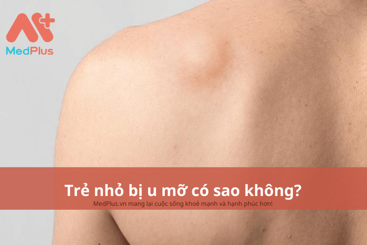 Trẻ nhỏ bị u mỡ có sao không?