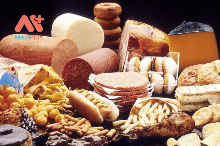 Người bị đau mắt nên tránh những loại thực phẩm nào? 132 Không nên ăn quá nhiều chất béo bão hòa