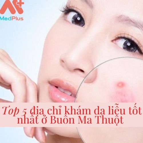 [Danh sách] Top 5 địa chỉ phòng khám da liễu tốt nhất ở Buôn Ma Thuột