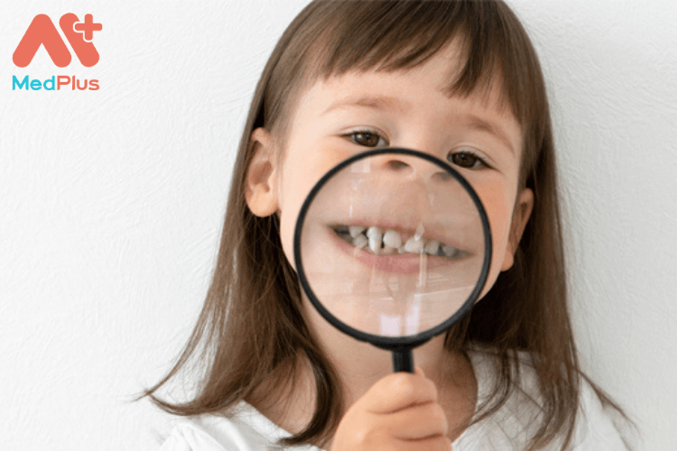 Trẻ nhỏ bị răng hô có sao không?