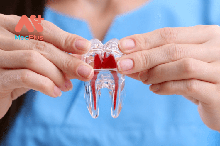 Trám răng nhiễm trùng bằng liệu pháp tế bào gốc