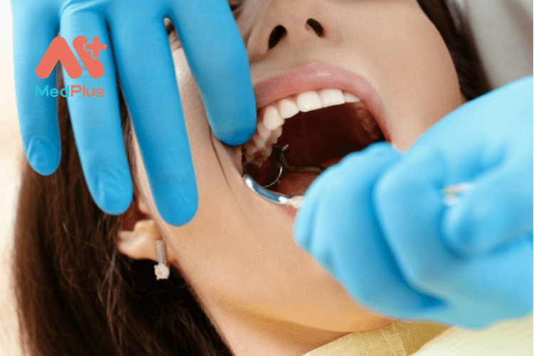 Bệnh viêm nướu răng