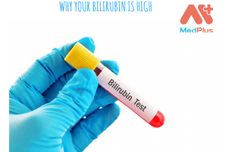 Chỉ số Bilirubin tăng cao hơn lượng bình thường sẽ có khả năng nhiễm các bệnh về gan cao hơn.