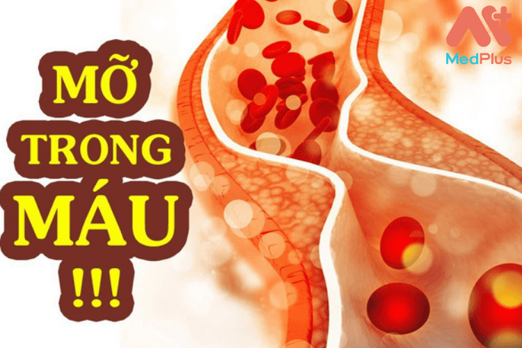 Chỉ số mỡ máu Triglyceride