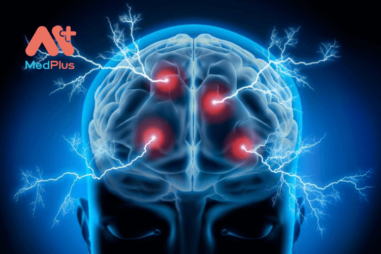 Động kinh - Quá trình xảy ra bên trong não