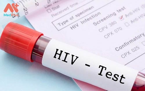 xét nghiệm HIV tại MEDLATEC