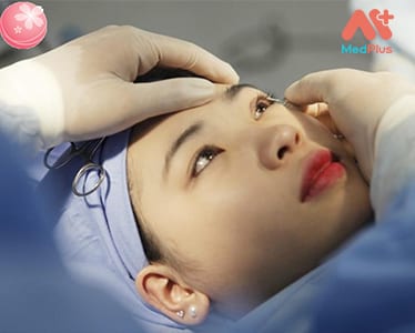 Phẫu thuật mắt tại JIEH