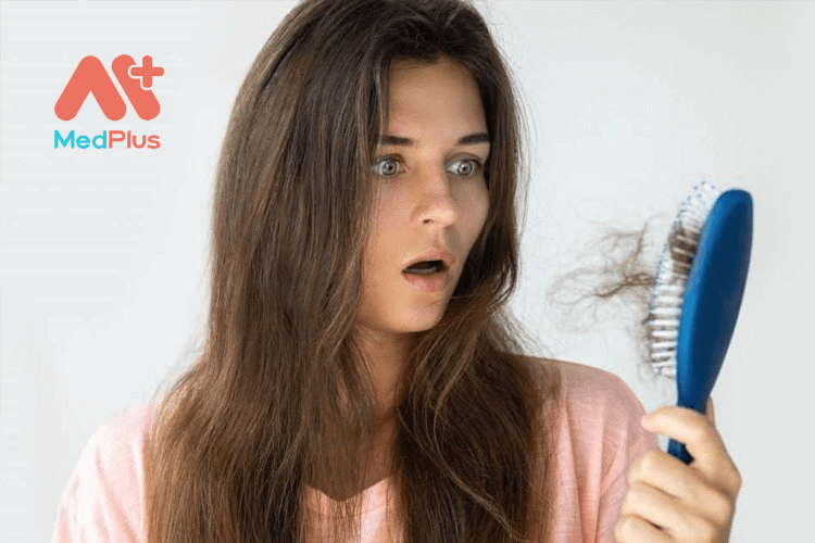 Bệnh rụng tóc là gì Nguyên nhân gây rụng tóc