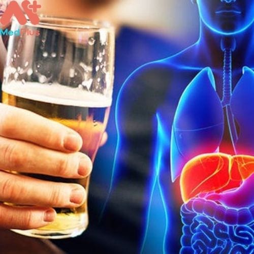 Các bệnh về gan, uống nhiều rượu bia là một nguyên nhân dẫn đến chỉ số GGT tăng cao