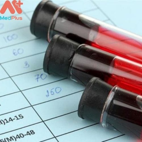 Chỉ số xét nghiệm MPV trong máu là xét nghiệm nhằm đo lường thể tích trung bình của tiểu cầu trong máu.