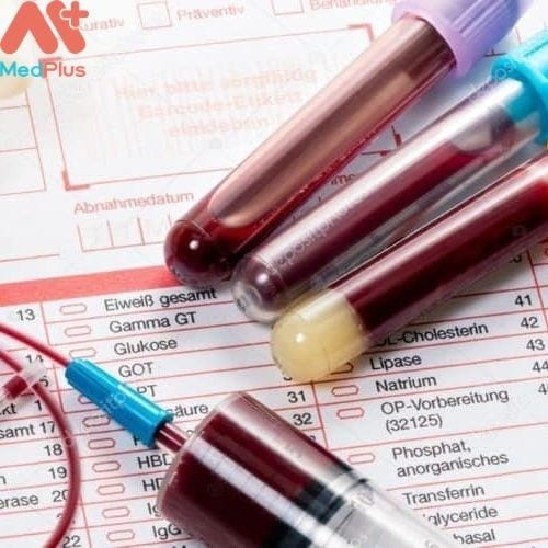 Chỉ số xét nghiệm máu MCHC có thể giúp chẩn đoán chứng rối loạn máu và đánh giá lượng sắt trong cơ thể