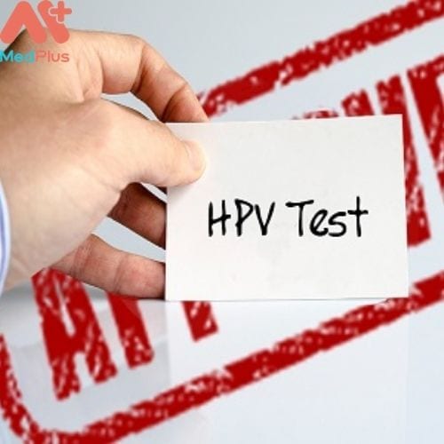 Xét nghiệm HPV