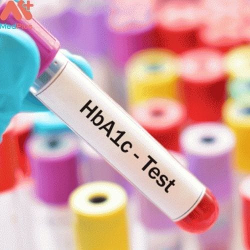 Xét nghiệm HbA1c máu