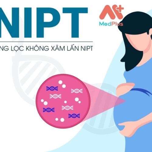 Xét nghiệm NIPT trước sinh là một bước tiến mới trong ngành y học hiện nay