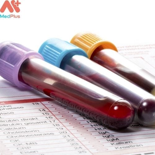 Xét nghiệm máu giúp xác định chỉ số bạch cầu