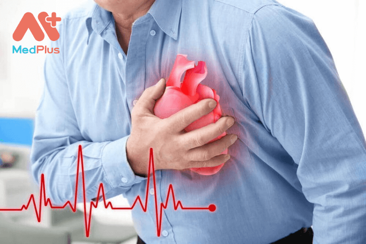 Định nghĩa đau tim gia đoạn sớm trong Quy tắc bảo hiểm bệnh hiểm nghèo PVI