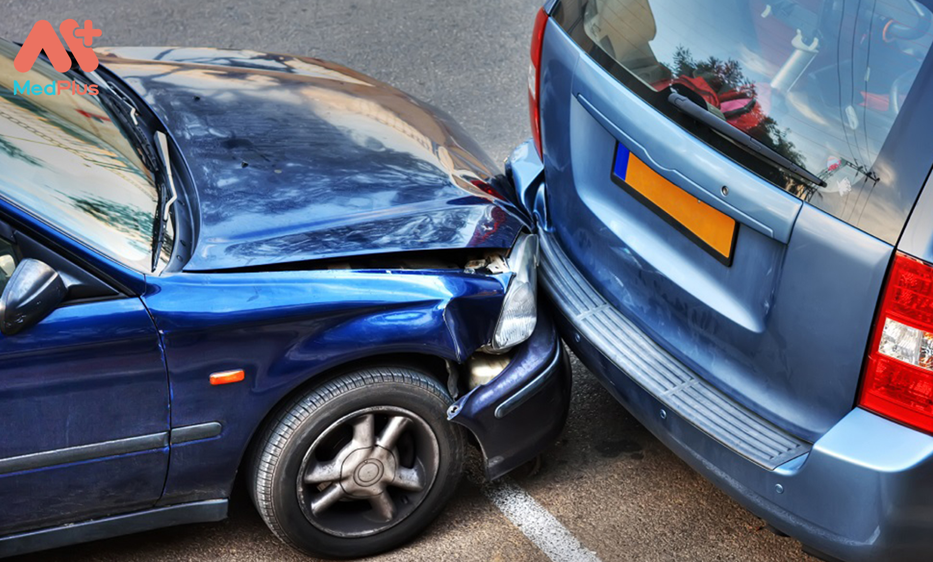 Giải đáp 3 thắc mắc phổ biến nhất về bảo hiểm ô tô