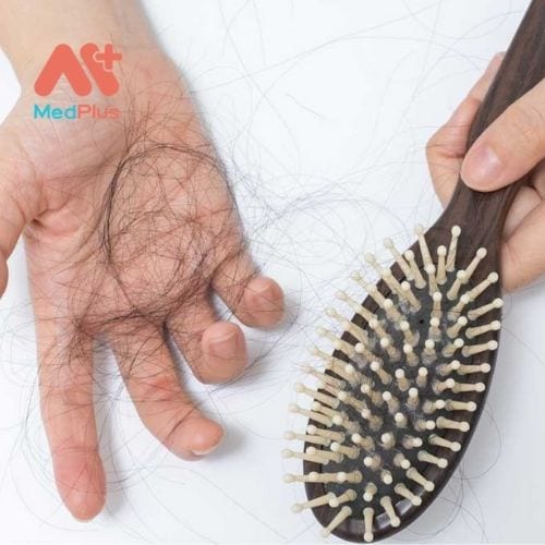 Rụng tóc là một trong những vấn đề thường gặp ở nhiều người, đặc biệt là ở phụ nữ.