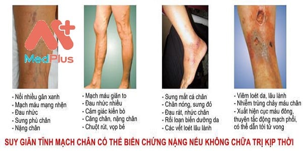 espere cach dung chi dinh tac dung can luu y than trong - Medplus