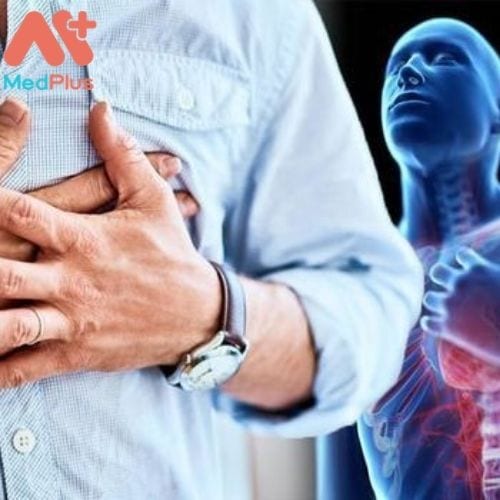 Viêm cơ tim có thật sự nguy hiểm không ? Dấu hiệu cảnh báo 129 Các triệu chứng viêm cơ tim