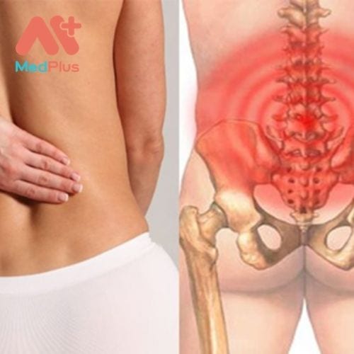 Đau lưng là triệu chứng bệnh khá phổ biến xảy ra do rất nhiều nguyên nhân khác nhau gây nên.