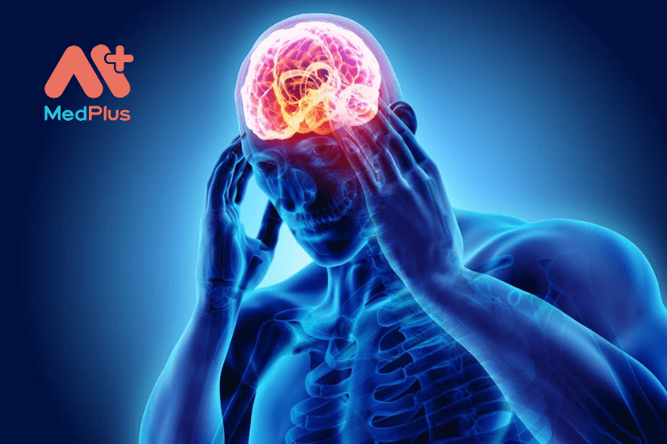 Tổn thương não hay chấn thương sọ não là gì