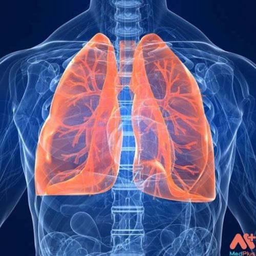 Triệu chứng về bệnh xơ phổi